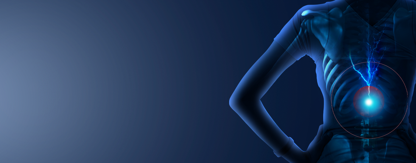 Peters Choice 배경